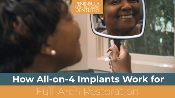 Discover how All-on-4 dental implants in Charleston, SC, can restore your smile! Learn about the procedure, benefits, and if it's right for you.