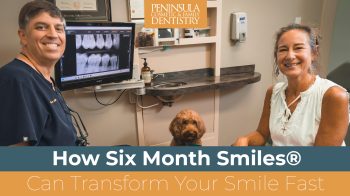 Straighten your teeth in as little as six months with Six Month Smiles® at Peninsula Cosmetic & Family Dentistry in Charleston, SC. Discreet, comfortable, and effective