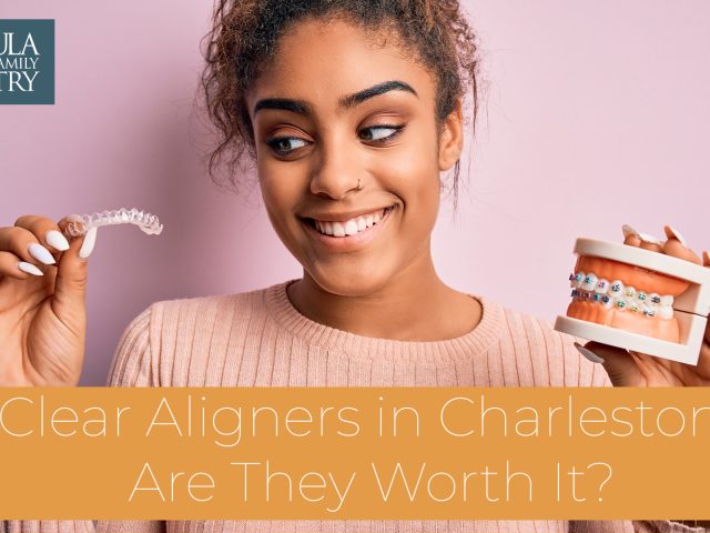 Clear Aligners in Charleston: Are They Worth It? (featured image)