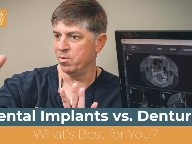 Dental Implants vs. Dentures: What’s Best for You? (featured image)