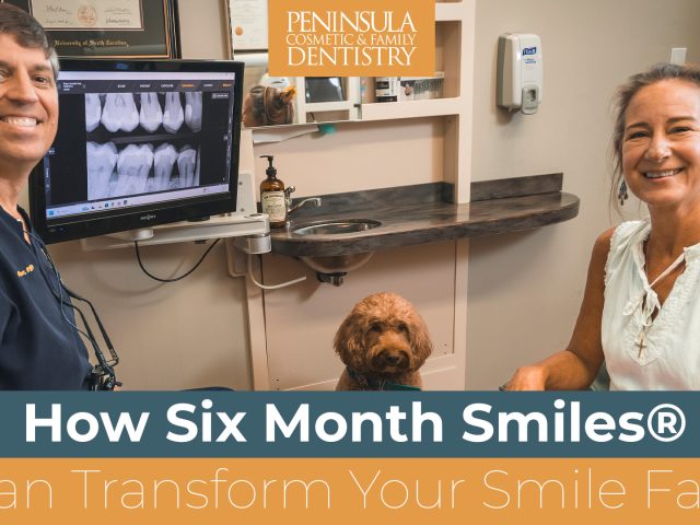 How Six Month Smiles® Can Transform Your Smile Fast (featured image)