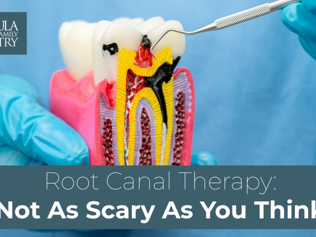 Root Canal Therapy: Not As Scary As You Think (Your Charleston, SC, Guide) (featured image)