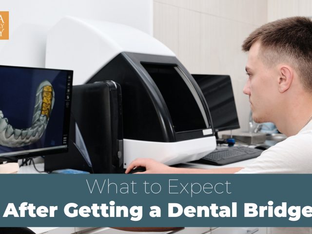What to Expect After Getting a Dental Bridge (featured image)